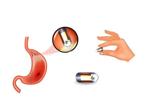 胃肠镜新时代：一颗神奇的胶囊内镜